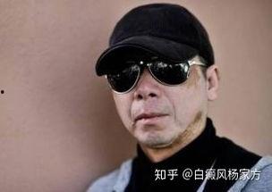 白癜风 明星,揭秘白癜风明星的勇敢面对